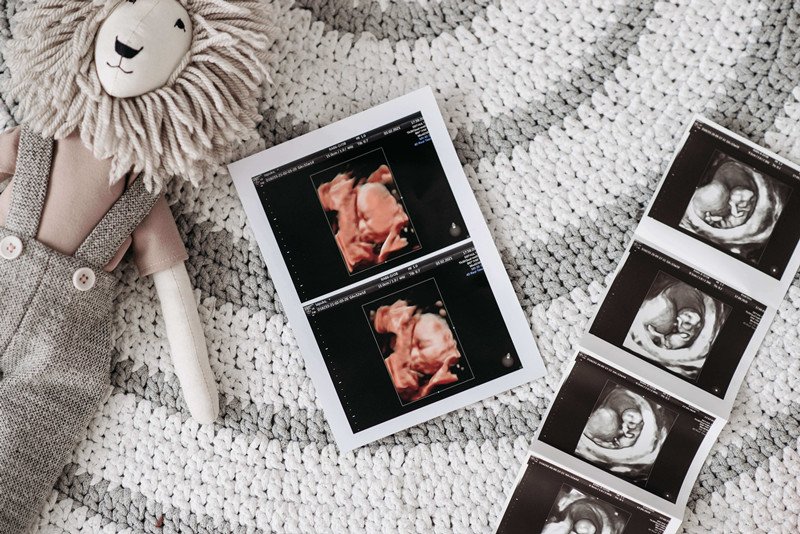 choose the ultrasound print paper